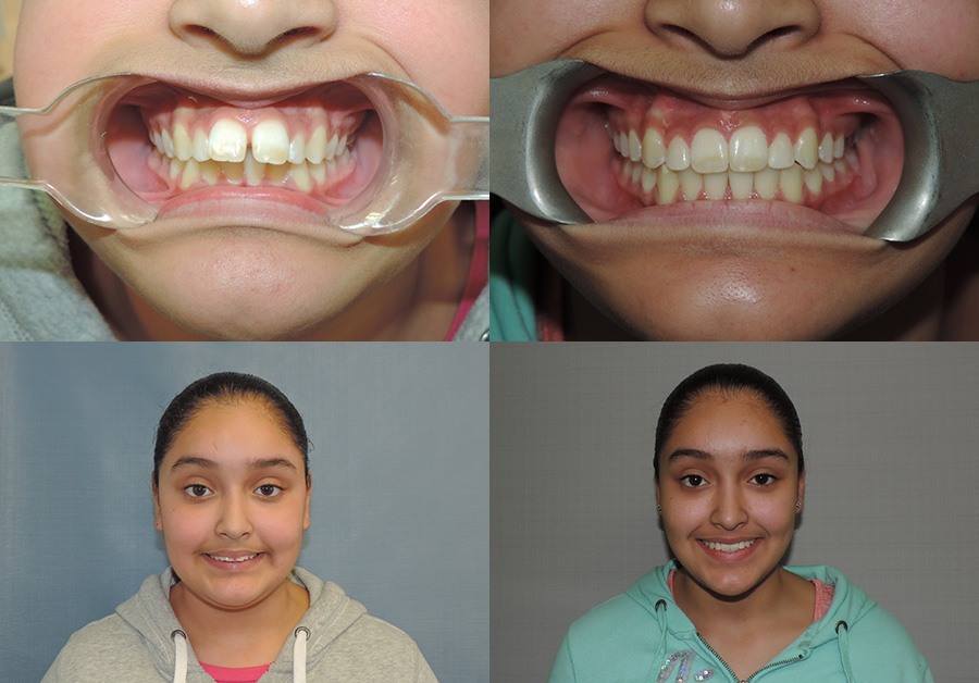 Yesnia's Smiles Change Lives Program Results